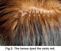 251021112059_Hair-Dying with henna-s.jpg